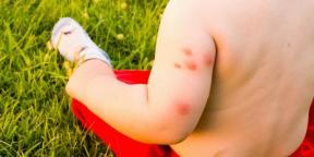 अगर आपको मच्छर और मिज के काटने से एलर्जी है तो क्या करें?