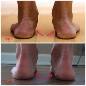 Minimalist जूते परिवर्तन पैर में चलाने के लिए कैसे