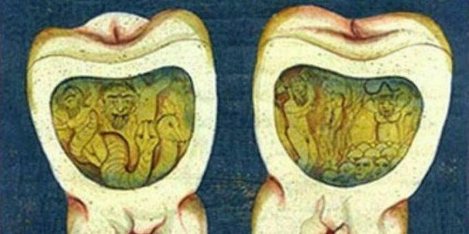 मध्यकालीन चिकित्सा: 17 वीं शताब्दी के ओटोमन साम्राज्य के दंत ग्रंथ से एक पृष्ठ।
